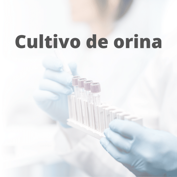 cultivo de orina análisis clínicos pyc