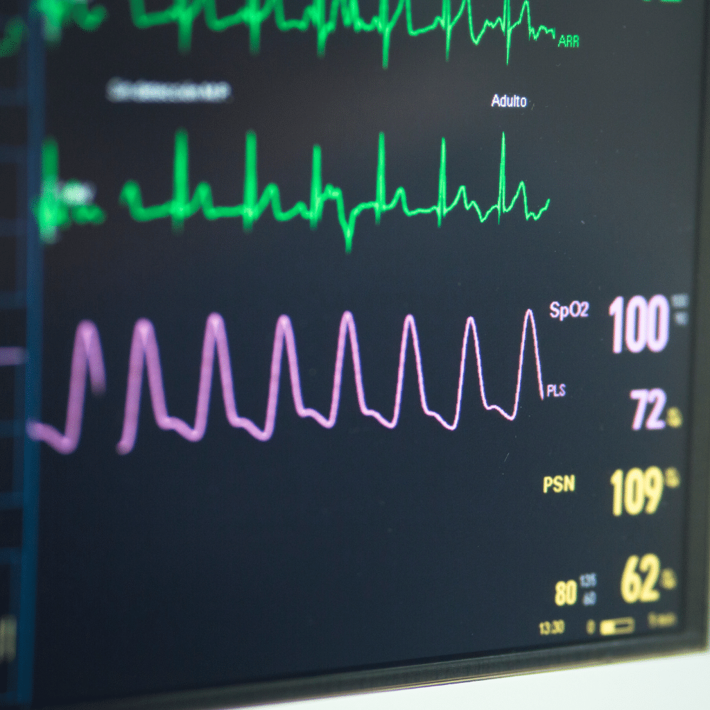 electrocardiograma