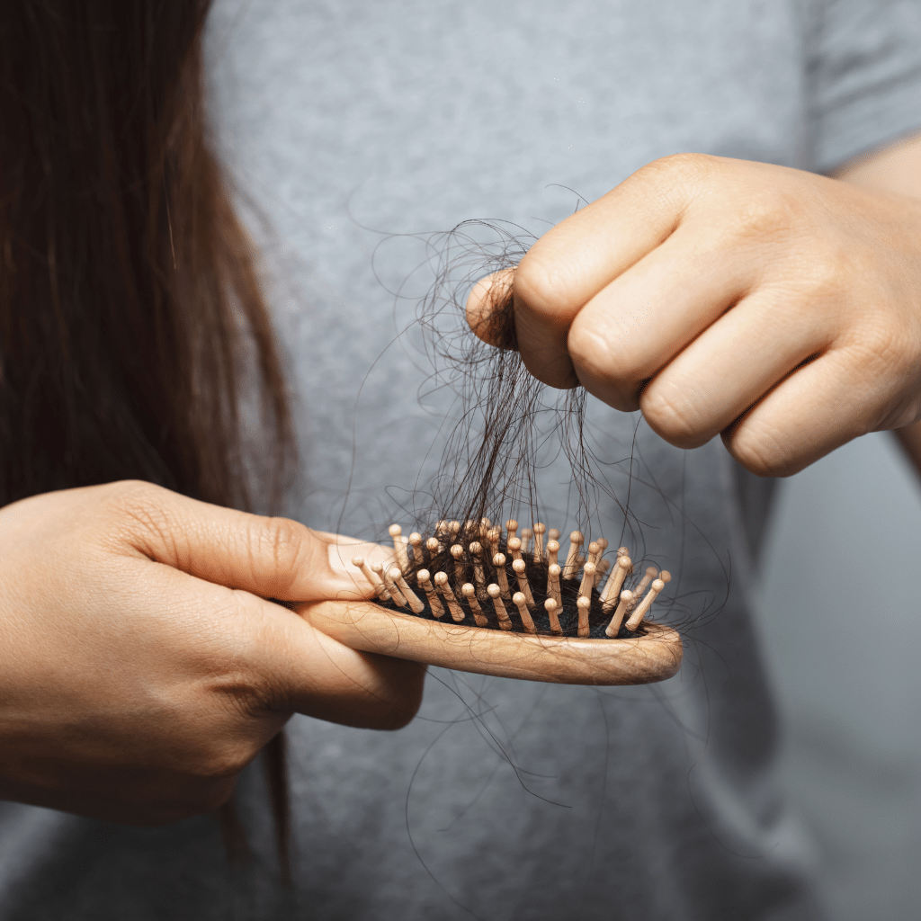 alopecia caída cabello