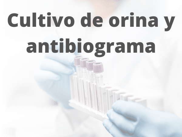 cultivo de orina análisis clínicos pyc