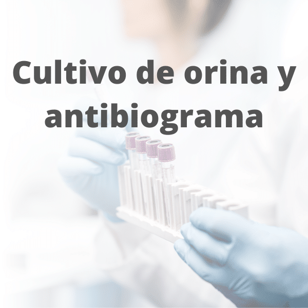 cultivo de orina análisis clínicos pyc